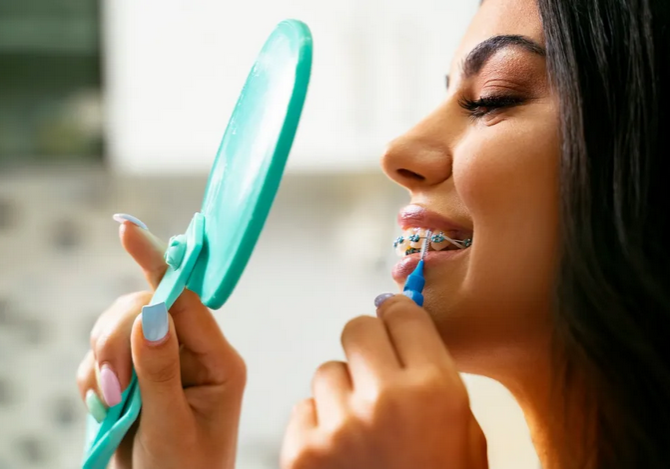 Maintaining Good Oral Hygiene With Braces